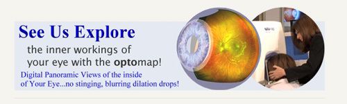 Optomap